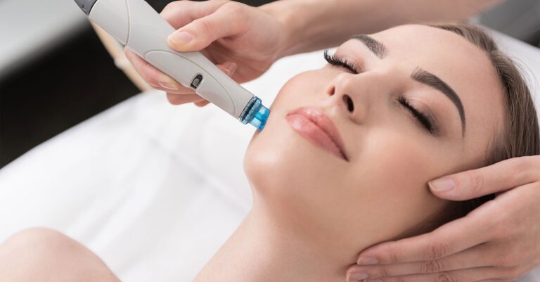 Ajenjo Vázquez 1 o 2 sesiones de microlifting facial de vitaminas con Dermapen para 1