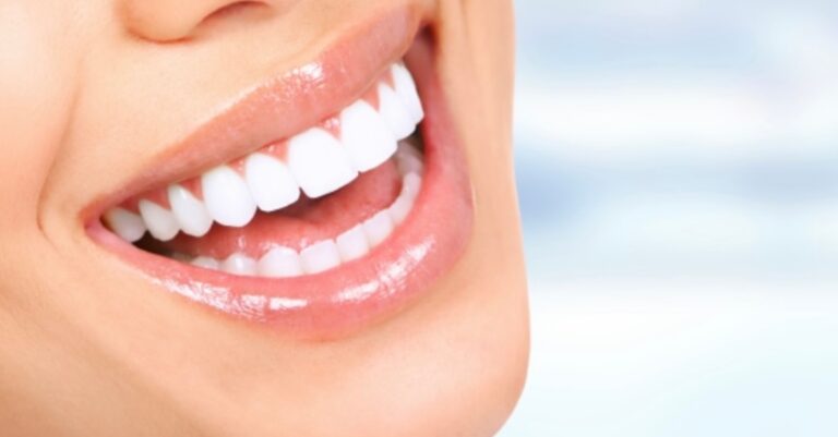Centro Odontológico Llorente Dental Blanqueamiento dental - en consu