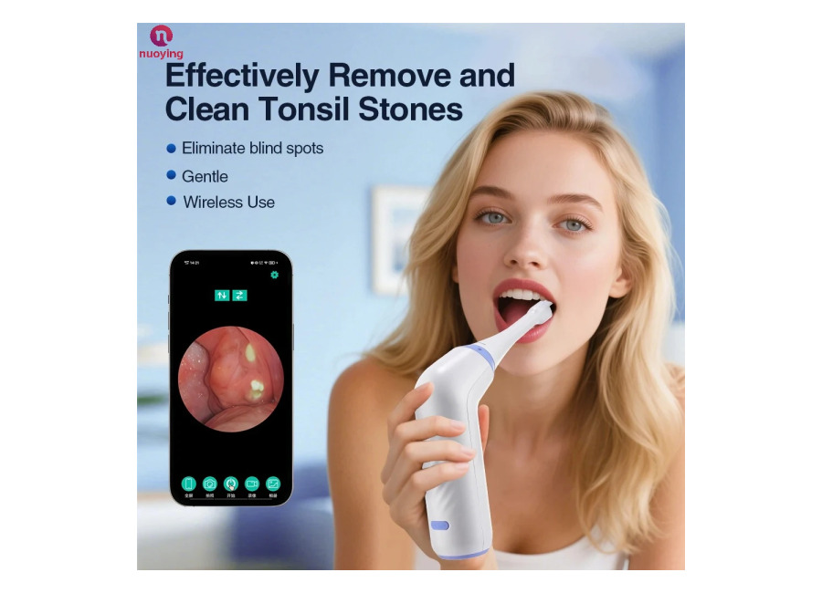 Extractor Eléctrico de Cálculos Amigdalinos con 3 Niveles de Succión, Herramienta Portátil de Cuidado Bucal, Alivia…