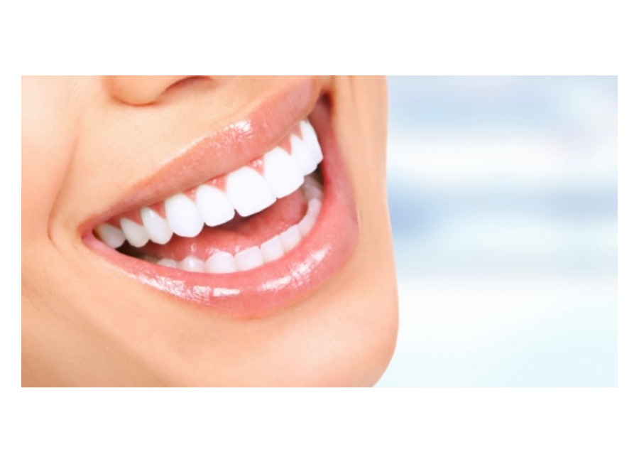 Centro Odontológico Llorente Dental Blanqueamiento dental – en consu